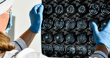 Mørketal og manglende diagnoser